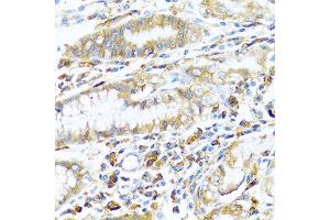 Immunohistochemistry of paraffin-embedded human stomach using HLA-DPB1 antibody at dilution of 1:100 (40x lens).