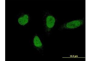Immunofluorescence of monoclonal antibody to RNF220 on HeLa cell. (RNF220 antibody  (AA 468-566))