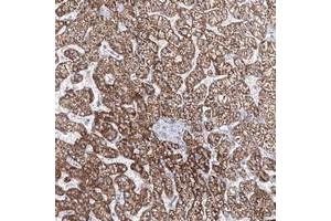 Immunohistochemical staining of human liver with CXXC4 polyclonal antibody  shows strong cytoplasmic positivity in hepatocytes at 1:50-1:200 dilution.