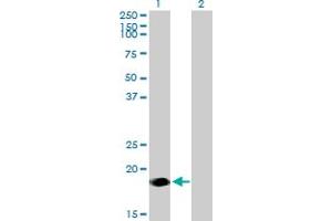 Western Blot analysis of NINJ2 expression in transfected 293T cell line by NINJ2 MaxPab polyclonal antibody.