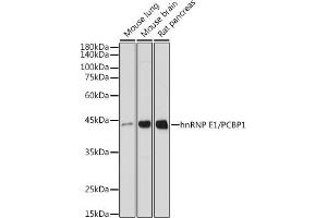 Western blot analysis of extracts of various cell lines, using hnRNP E1/hnRNP E1/PCBP1 antibody (ABIN7269448) at 1:1000 dilution. (PCBP1 antibody)