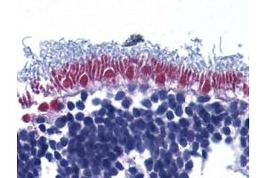 Immunohistochemistry of AIF in human retina with AIF (IN) antibody at 10μg/ml. (AIF antibody)