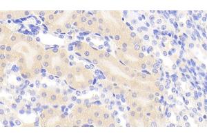 Immunohistochemistry (IHC) image for anti-Eukaryotic Translation Initiation Factor 2-alpha Kinase 3 (EIF2AK3) (AA 973-1114) antibody (ABIN7441241)