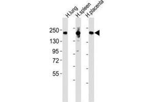 Western blot testing of MRC1L1 antibody at 1:2000 dilution and human samples: Lane 1: lung lysate; 2: spleen lysate; 3: placenta lysate; Predicted band size : 166 kDa. (Macrophage Mannose Receptor 1 antibody  (AA 359-388))
