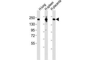 Western blot testing of MRC1L1 antibody at 1:2000 dilution and human samples: Lane 1: lung lysate; 2: spleen lysate; 3: placenta lysate; Predicted band size : 166 kDa. (Macrophage Mannose Receptor 1 antibody  (AA 359-388))