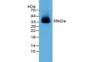 Figure. (PVRL2 antibody  (AA 83-291))
