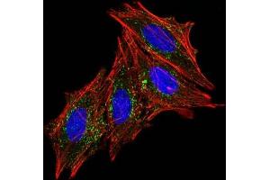 Immunofluorescence (IF) image for anti-CD63 (CD63) antibody (ABIN6941230)