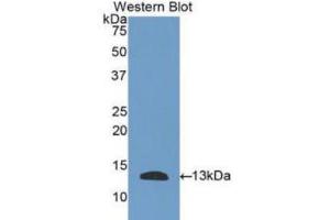 Western blot analysis of the recombinant protein. (PLAUR antibody  (AA 123-216))