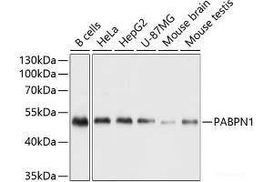 Western blot analysis of extracts of various cell lines using Polyclonal AntibodyPN1 Polyclonal Antibody at dilution of 1:1000. (PN1 antibody)