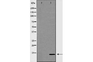 Western blot analysis of INSL3 expression in MCF7 cells,The lane on the left is treated with the antigen-specific peptide. (INSL3 antibody  (Internal Region))