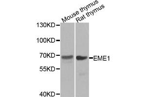 Western blot analysis of extracts of mouse thymus and rat thymus tissues, using EME1 antibody. (Crossover junction endonuclease EME1 (EME1) antibody)