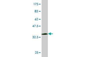 Western Blot detection against Immunogen (38. (DDT antibody  (AA 1-118))