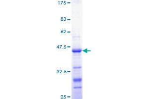 CTNNB1 Protein (AA 682-781) (GST tag)