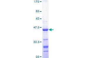 CTNNB1 Protein (AA 682-781) (GST tag)