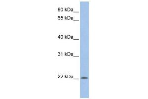 UBE2M antibody used at 1 ug/ml to detect target protein. (UBE2M antibody)