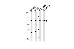Western blot analysis of lysates from S, PC-3 cell line, mouse kidney, rat kidney tissue lysate (from left to right), using SUPV3L1 Antibody (N-term) (ABIN1881857 and ABIN2843036). (SUPV3L1 antibody  (N-Term))