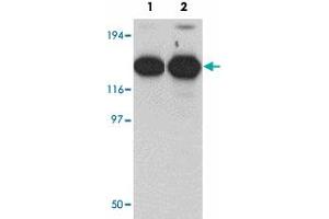 Western blot analysis of ZMYM2 in EL4 cell lysate with ZMYM2 polyclonal antibody  at (1) 0. (ZMYM2 antibody  (C-Term))