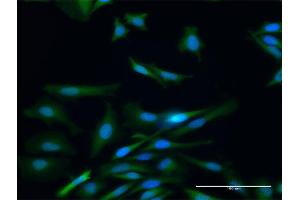 Immunofluorescence of purified MaxPab antibody to PADI4 on HeLa cell. (PAD4 antibody  (AA 1-663))