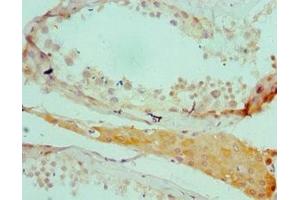 Immunohistochemistry of paraffin-embedded human testis tissue using ABIN7168578 at dilution of 1:100 (SALL4 antibody  (AA 1-220))