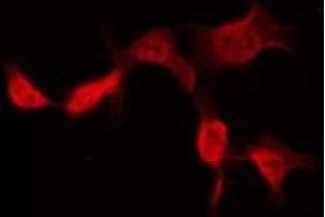 ABIN6275402 staining Hela by IF/ICC. (POTEB antibody)