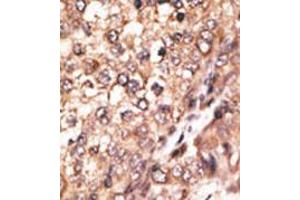 Image no. 2 for anti-Bone Morphogenetic Protein 7 (BMP7) (N-Term) antibody (ABIN357185) (BMP7 antibody  (N-Term))