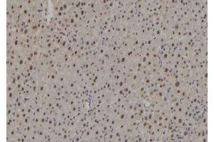 ABIN6276941 at 1/100 staining Rat liver tissue by IHC-P.