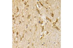 Immunohistochemistry of paraffin-embedded mouse brain using APLP1 antibody at dilution of 1:200 (400x lens). (APLP1 antibody)
