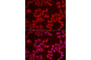 Immunofluorescence analysis of HeLa cell using BAP1 antibody. (BAP1 antibody)