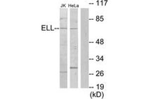 Western blot analysis of extracts from Jurkat/HeLa cells, using ELL Antibody.