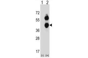 Western blot analysis of BCAT2 (arrow) using rabbit polyclonal BCAT2 Antibody (C-term) .