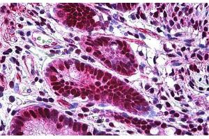 Immunohistochemistry (Formalin-fixed Paraffin-embedded Sections) (IHC (fp)) image for anti-X-Ray Repair Complementing Defective Repair in Chinese Hamster Cells 6 (XRCC6) (AA 1-610) antibody (ABIN626028)