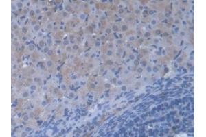 Detection of VARS in Mouse Ovary Tissue using Polyclonal Antibody to Valyl tRNA Synthetase (VARS) (VARS antibody  (AA 186-421))