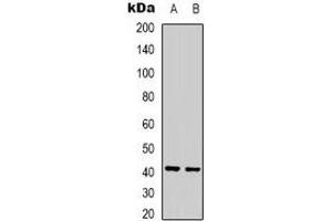 Western blot analysis of Ghrelin Receptor expression in Jurkat (A), rat liver (B) whole cell lysates. (GHSR antibody)