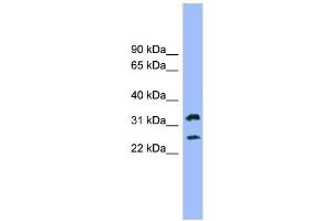 WB Suggested Anti-FCER1A Antibody Titration: 0. (Fc epsilon RI/FCER1A antibody  (N-Term))