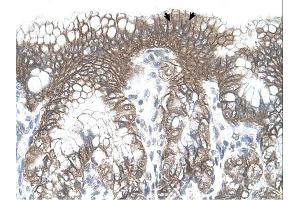 TARS antibody was used for immunohistochemistry at a concentration of 4-8 ug/ml. (TARS antibody  (N-Term))