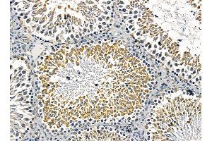 ABIN7095431 and ABIN7099488 at 1/100 staining rat testis tissue by IHC-P. (OSBPL5 antibody)