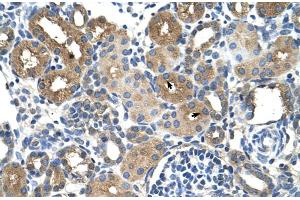 Human kidney (DCXR antibody  (Middle Region))