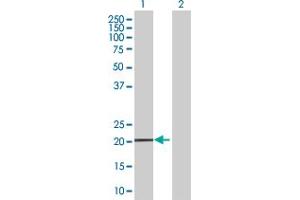 Western Blot analysis of MS4A4A expression in transfected 293T cell line by MS4A4A MaxPab polyclonal antibody. (MS4A4A antibody  (AA 1-220))