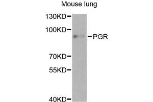 Western blot analysis of extracts of mouse lung, using PGR antibody. (Progesterone Receptor antibody)