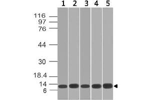 Image no. 1 for anti-S100 Calcium Binding Protein A8 (S100A8) antibody (ABIN5026984) (S100A8 antibody)