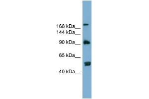 WB Suggested Anti-ATG2A  Antibody Titration: 0. (ATG2A antibody  (N-Term))