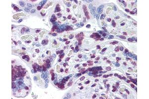Anti-RBM5 antibody IHC of human placenta. (RBM5 antibody  (AA 75-184))