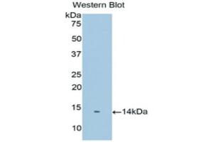 Western Blotting (WB) image for anti-Prostate Stem Cell Antigen (PSCA) (AA 22-123) antibody (ABIN1175802) (PSCA antibody  (AA 22-123))