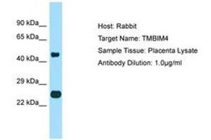 Image no. 1 for anti-Transmembrane BAX Inhibitor Motif Containing 4 (TMBIM4) (AA 110-159) antibody (ABIN6750079) (TMBIM4 antibody  (AA 110-159))