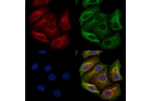 ABIN6263822 and ABIN6272378 staining Hela cells by IF/ICC. (MOG antibody  (Internal Region))