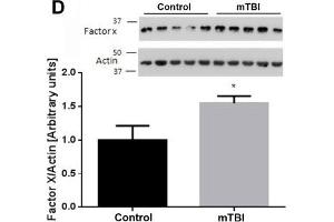 At two weeks upon injury, brain thrombin activity and concentration are similar between mTBI exposed animals and controls. (Factor 10 Heavy Chain (AA 351-448) antibody)