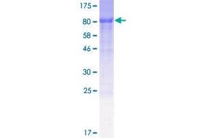 Image no. 1 for Melanoma Associated Antigen (Mutated) 1-Like 1 (MUM1L1) (AA 1-425) protein (GST tag) (ABIN1311650) (MUM1L1 Protein (AA 1-425) (GST tag))