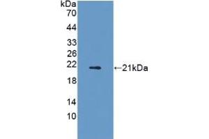 Western blot analysis of recombinant Rat ADIPoR2. (Adiponectin Receptor 2 antibody  (AA 1-147))