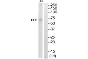 Western Blotting (WB) image for anti-CD6 (CD6) (Internal Region) antibody (ABIN1852261) (CD6 antibody  (Internal Region))