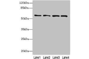 Western blot All lanes: FLAD1 antibody at 4 μg/mL Lane 1: K562 whole cell lysate Lane 2: HepG2 whole cell lysate Lane 3: MDA-MB-231 whole cell lysate Lane 4: Hela whole cell lysate Secondary Goat polyclonal to rabbit IgG at 1/10000 dilution Predicted band size: 66, 55, 50, 33, 37 kDa Observed band size: 66 kDa